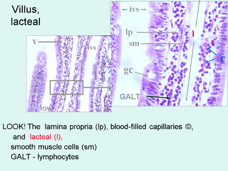 Villus, lacteal  LOOK! The  lamina propria (lp), blood-filled capillaries ©,  